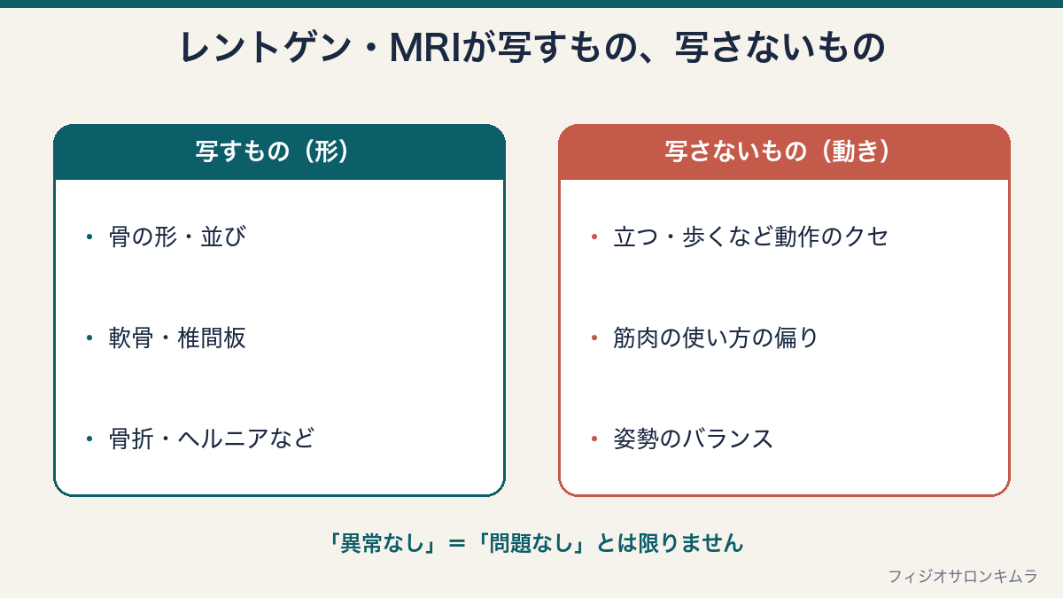 レントゲン・MRIが写すもの（骨の形・軟骨・骨折など）と写さないもの（動作のクセ・筋肉の使い方・姿勢のバランス）の比較図