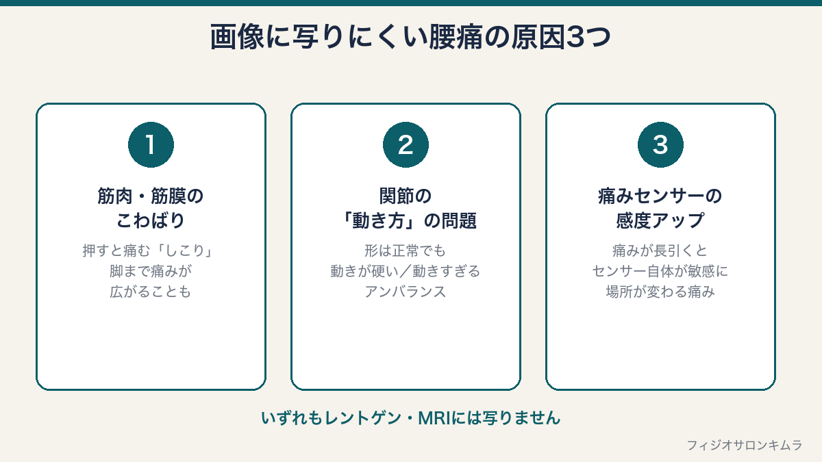 画像に写りにくい腰痛の3つの原因の図解:筋肉・筋膜のこわばり、関節の動き方の問題、痛みセンサーの感度アップ