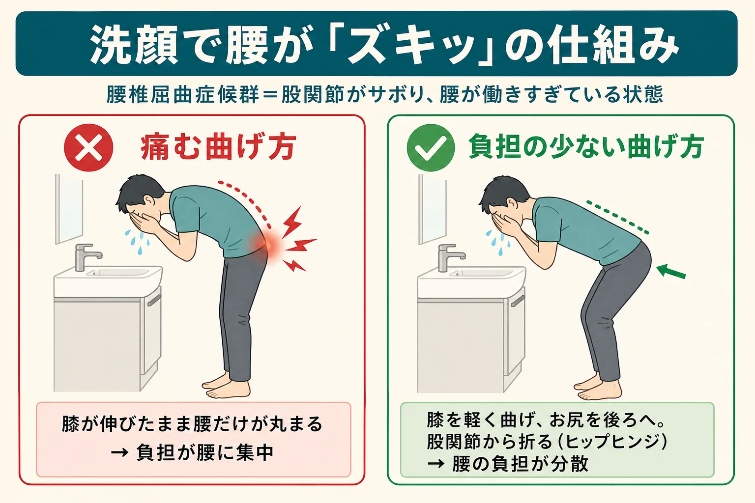 洗顔で腰が痛む仕組みの比較図:膝が伸びたまま腰だけ丸まると負担が腰に集中/膝を曲げてお尻を後ろに引くヒップヒンジなら腰の負担が分散
