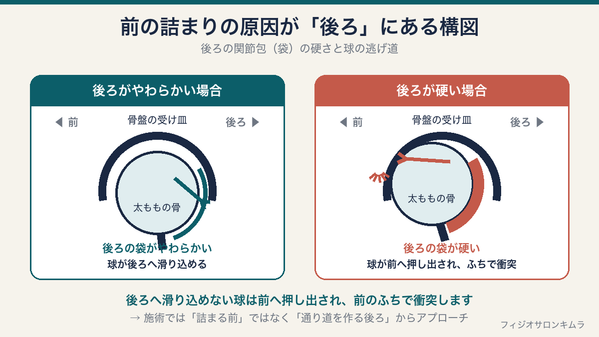 後ろの関節包がやわらかい場合は球が後ろへ滑り込めるが、硬い場合は球が後ろへ行けず前へ押し出され、前のふちで衝突する仕組みの比較図