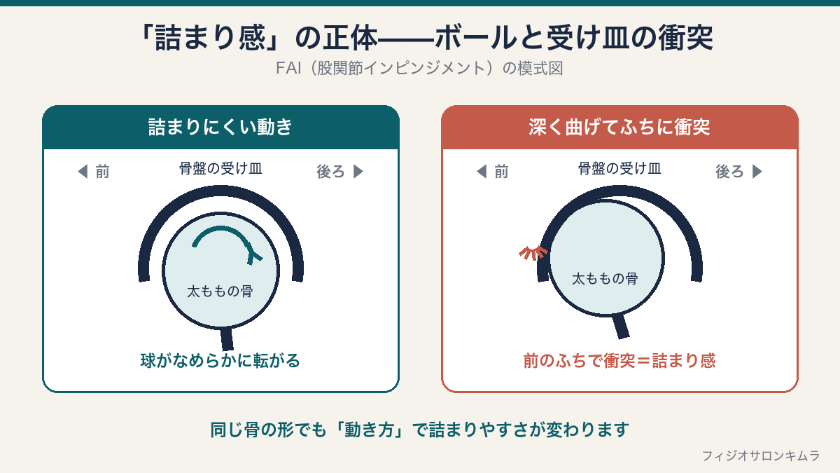 股関節をボールと受け皿にたとえた模式図。球がなめらかに転がる場合と、深く曲げたときに前のふちで衝突して詰まり感が出る場合(FAI)の比較